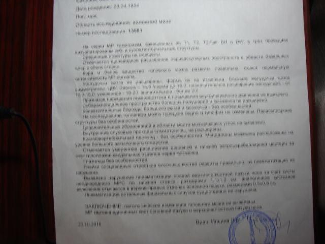 Двоение в глазах