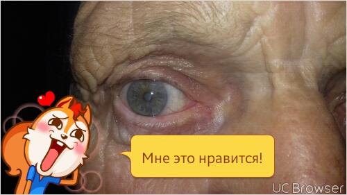 Самое лучшее лекарство от катаракты Самое лучшее лекарство от катаракты